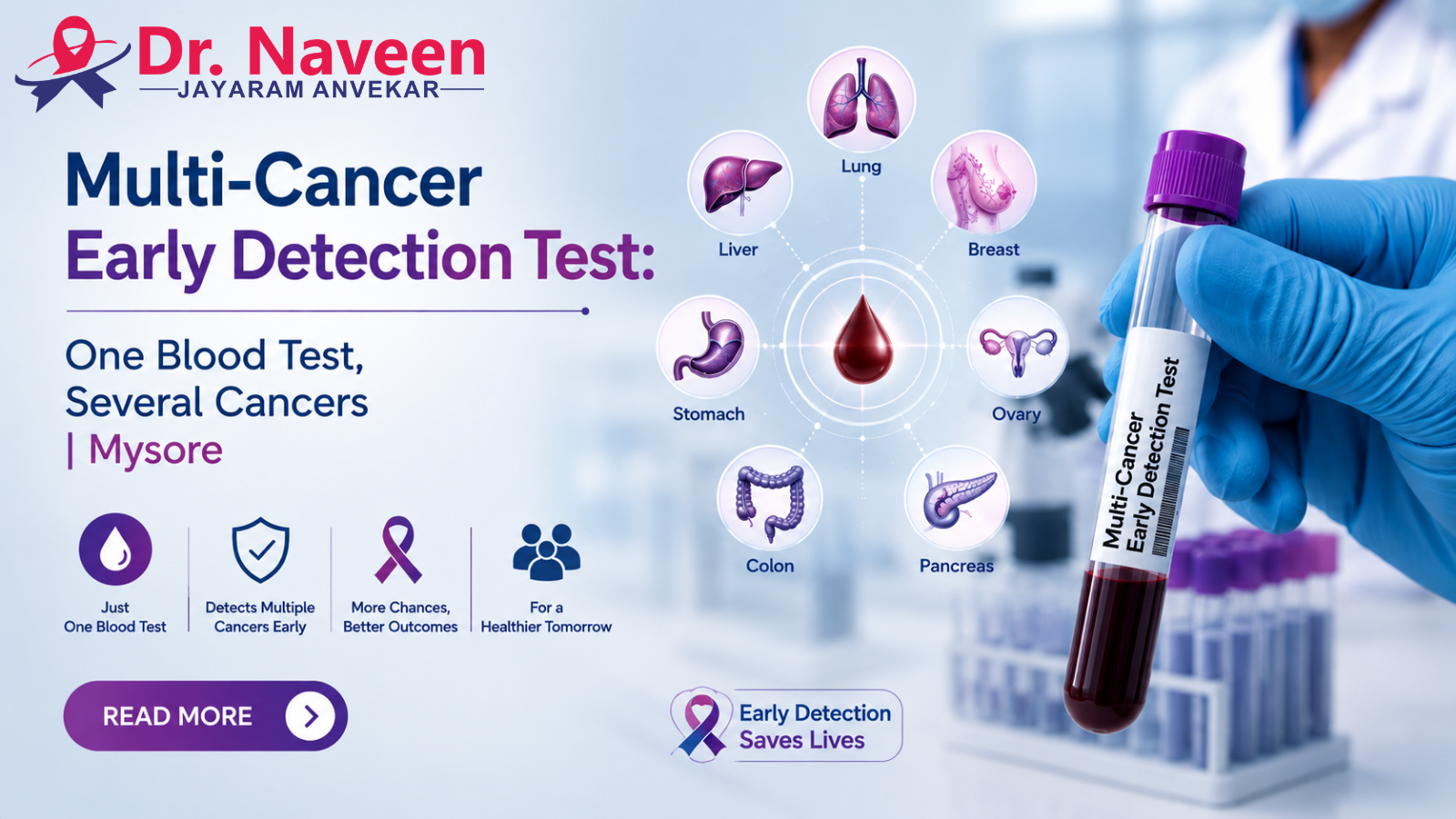 Multi-Cancer Early Detection Test: One Blood Test, Several Cancers | Mysore